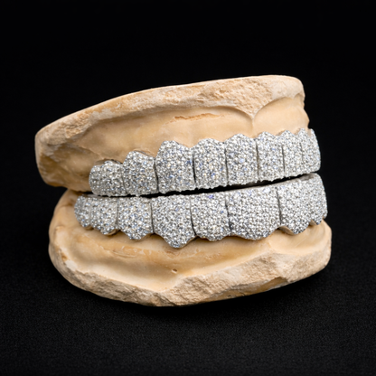 Fully Iced VVS Diamond Grillz Set – Luxury Hip Hop Teeth Jewelry