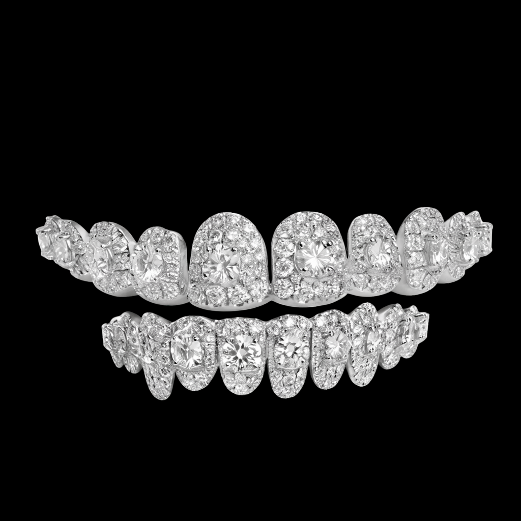 Luxury Round Cut Iced-Out Diamond Grillz (Full Set)