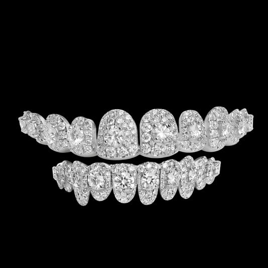 Luxury Round Cut Iced-Out Diamond Grillz (Full Set)