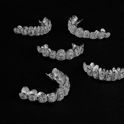 Luxury Round Cut Iced-Out Diamond Grillz (Full Set)