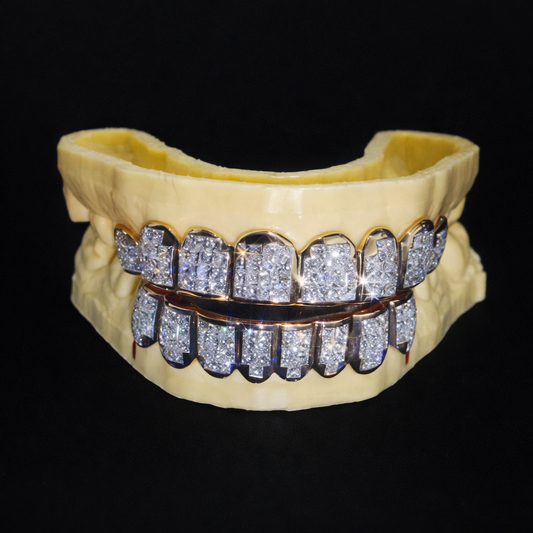 Two-Tone Iced Out Diamond Grillz (Top & Bottom Set)