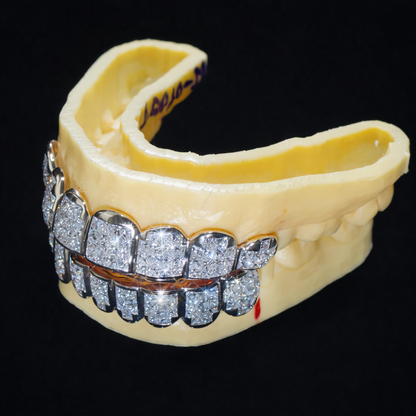 Two-Tone Iced Out Diamond Grillz (Top & Bottom Set)