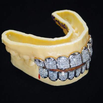 Two-Tone Iced Out Diamond Grillz (Top & Bottom Set)